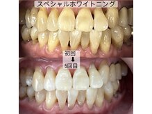 ヤット 森ノ宮(yatto.)/70代女性