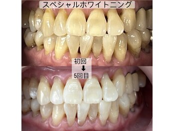 ヤット 森ノ宮(yatto.)/70代女性