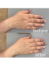 オテテ アイアンドハンド(otete eye&hand)/ハンドケアビフォーアフター