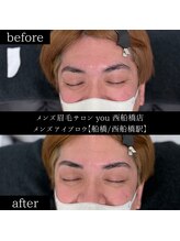 ユー 西船橋店(you)/ビフォーアフターお写真