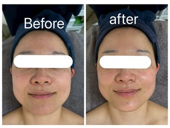 ラヴィエールフローラ(Laviere Flora)/フェイシャル