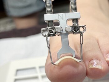 ネイルサロン ユーズ(USE.)の写真/爪の悩みをほどいて、自由な足元へ