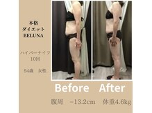 ベルナ(BELUNA)/50代のダイエットBefore After 