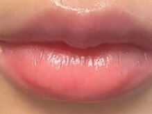 ホワイトニングサロンブライト 新宿店(Whitening salon bright)
