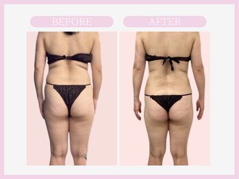 スリムライン 仙台店(The Slim Line)/before→after