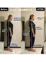 ハクト(HacT)/BeforeAfter