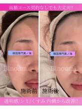 美ノ海/１回で憧れの水光肌に！