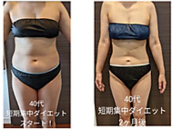 ローブメール(Robemail)/ビフォーアフター