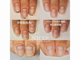 自爪育成中（クリア仕上げ）