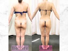 パラディ(PARADIS)/ハイパーナイフ/シェイプ/コルギ