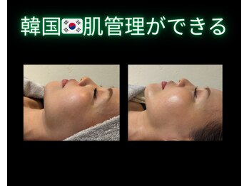 リオル(Rior)の写真/韓国でも人気【ソフニウム】ブライト効果&リフトアップ／脂肪分解頬小顔★肌深部から引き締まった肌に