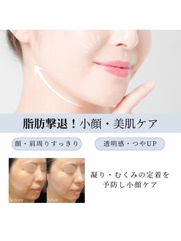 ビボーラ(BEBEAURA)の写真/ほうれい線・たるみ改善！機械と筋肉運動で小顔へ◎コリも解消し、理想のハリ肌へ♪