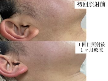 テンパ ビューティー(+10%beauty)/効果写真