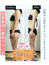 サロンデュヒャーク 志木駅前店(salon du ひゃーく)/症例写真【痩身】