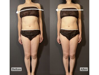 サロンドカメリア(salon de Camellia)/血流ケアはバランスが整います