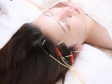 アキュレ(Acure)/★頭皮洗浄・頭皮鍼ヘッドスパ★