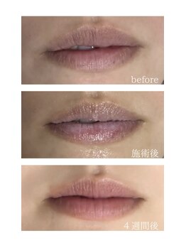 サロンドダリア(Salon de Dahlia)/大人気!ローマピンク