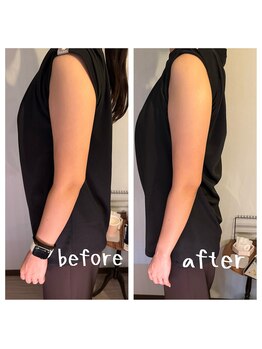 ニコ(niko)/痩身マシン×プロ整体