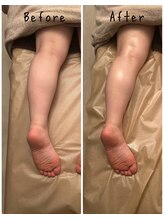 フィール(feel)/Before/After リンパマッサージ