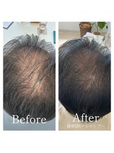 クリスタルグロウ 苫小牧大町店(Crystal Glow)/CURAIM 育毛促進施術