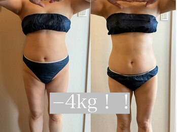 グレイティア(gratia)/眠れる痩身でボディライン整え!