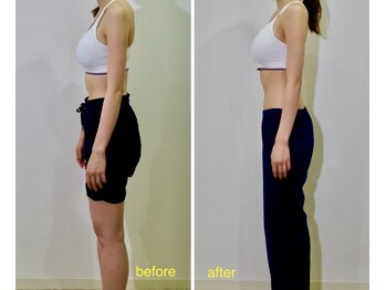 アズール(azure)/美容整体で、姿勢の改善