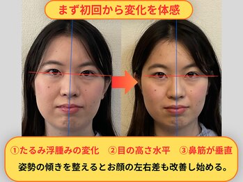 メディピークス/初回の変化