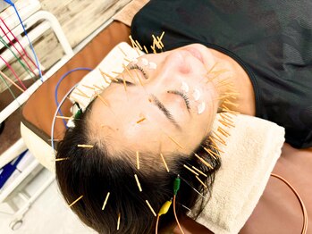 クローバー治療院の写真/大人女性のゆるみ・冷え、疲れに。美容鍼と整体でお悩みを根本改善