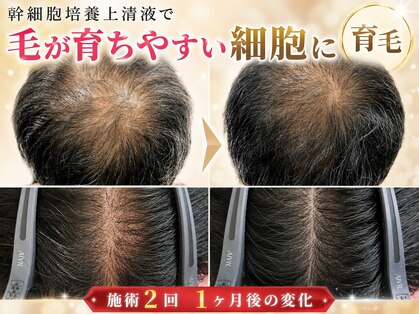 エターナル(Eternal)の写真