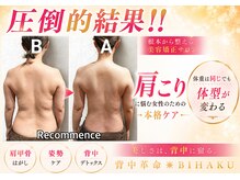 リコメンス(Recommence)