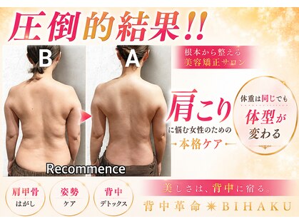 リコメンス(Recommence)の写真