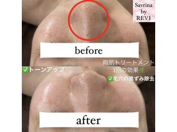 サブリナバイ ルヴィ(savrina by REVI)/毛穴知らずの陶器肌に