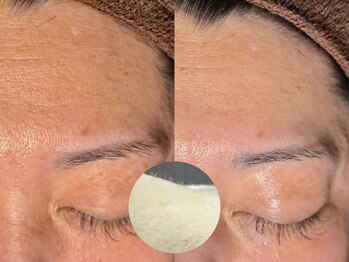 ルーナジェーナ(Luna llena)/池袋 エステ ルーナジェーナ