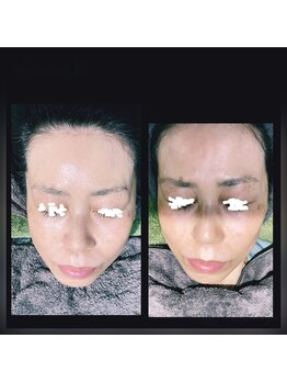 ココスタイルビューティー(COCOSTYLE beauty)/ララピール