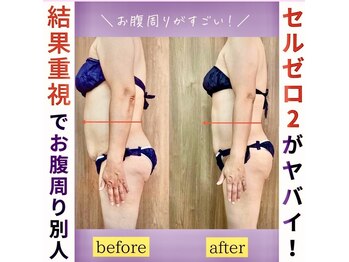 ソフィア(SOPHIA)