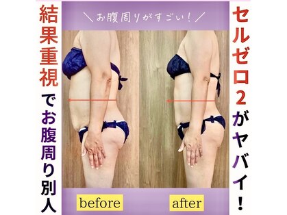 ソフィア(SOPHIA)の写真