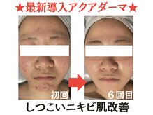 トータルボディケアサロン カラー(CALLA)