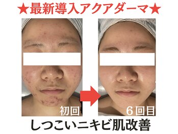 トータルボディケアサロン カラー(CALLA)