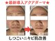 トータルボディケアサロン カラー(CALLA)の写真