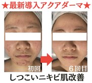 トータルボディケアサロン カラー(CALLA)