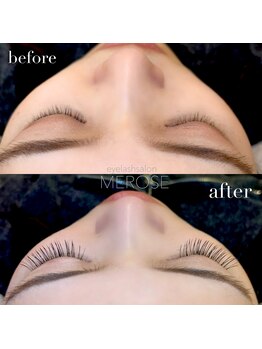 メローズ(Merose)/