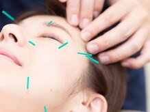 こらんこらん鍼灸院