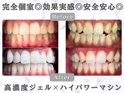 ホワイトニングビューティー 金沢駅前店(WHITENING BEAUTY)の写真