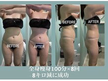 ミミロンビューティー(Mimiron Beauty)の雰囲気（私は痩せにくいから…体質だから…と諦める前にご相談下さい！）