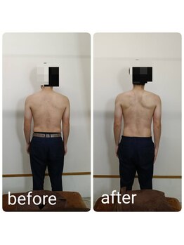 ククナ 長岡西店(KUKUNA)/姿勢改善矯正コース