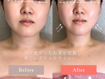 フィオーレ 佐賀巨勢店(Feaure)の写真
