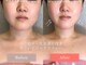 フィオーレ 佐賀巨勢店(Feaure)の写真