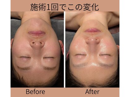 アイセ(AISE)の写真