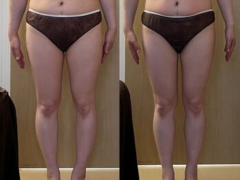 マイティー整骨院 ココア(CoCoa)/活性リンパ洗浄