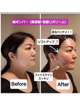 ラ コンシェル 武蔵小杉店/鍼ボンバー、お客様の結果